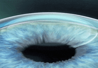 VISUMAX 800