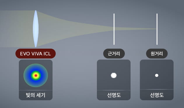 노안 근시 동시 교정